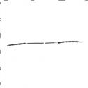 Picture of Cable - Accelerator